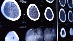 Brain scan image